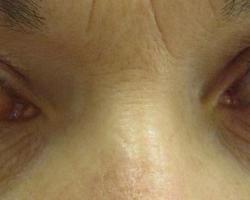 Badania przesiewowe pomogą wykryć jaskrę