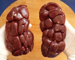 Oddajesz nerkę, ratujesz życie