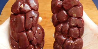 Oddajesz nerkę, ratujesz życie