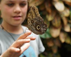 "Dzieci motyle" cierpią z powodu delikatnej skóry