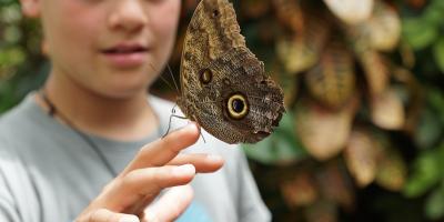 "Dzieci motyle" cierpią z powodu delikatnej skóry