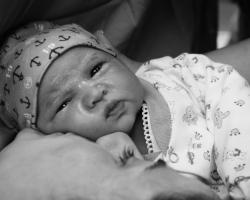 Żółtaczka noworodków – jak rozpoznać? Jak leczyć? 