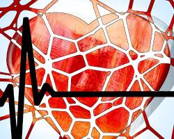 Rozpuszczalne stenty - czwarta rewolucja w kardiologii 