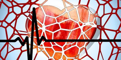 Soluble stents - the fourth revolution in cardiology
