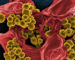 Hospital-acquired infections – how can we prevent them?