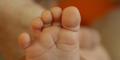 Haluksy, czyli kłopoty z koślawymi paluchami