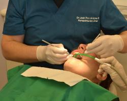 Rules of refunds for dental prosthetics