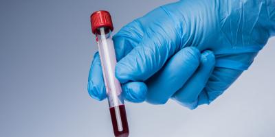 Badania genetyczne odgrywają coraz większą rolę przy diagnostyce nowotworów 